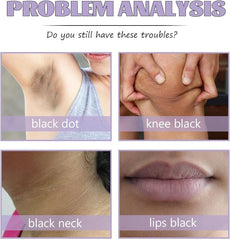Intimate Lightening Cream inner thighs improves tone in sensitive areas.