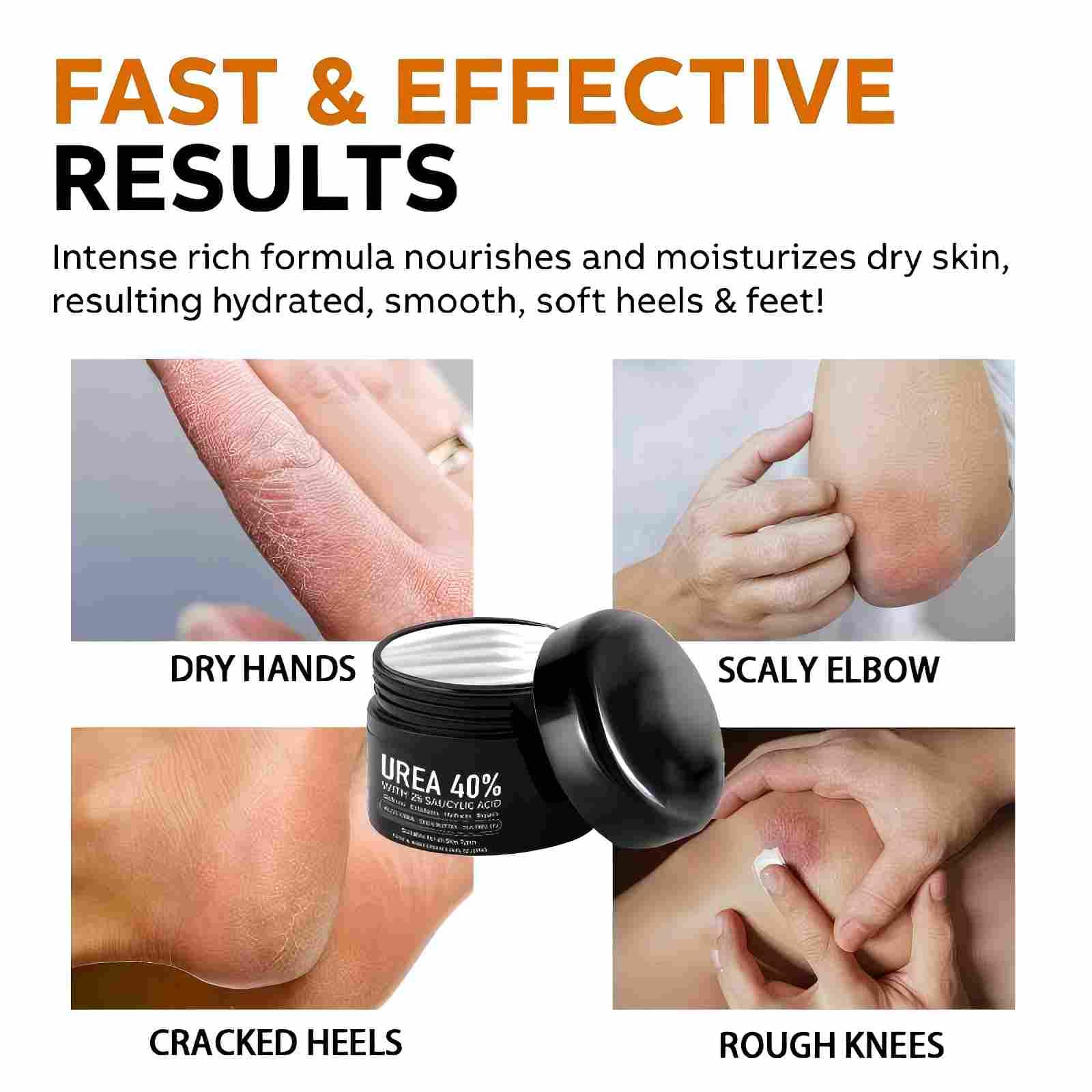 IOIOTCO Urea Cream on feet and heels for smoother skin.