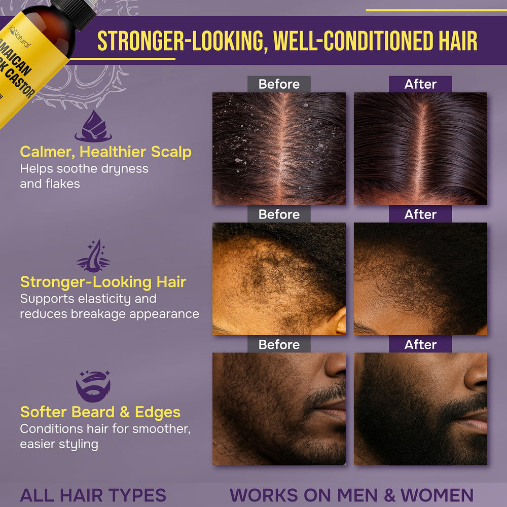 IQNatural castor oil applied to scalp for conditioning and shine.