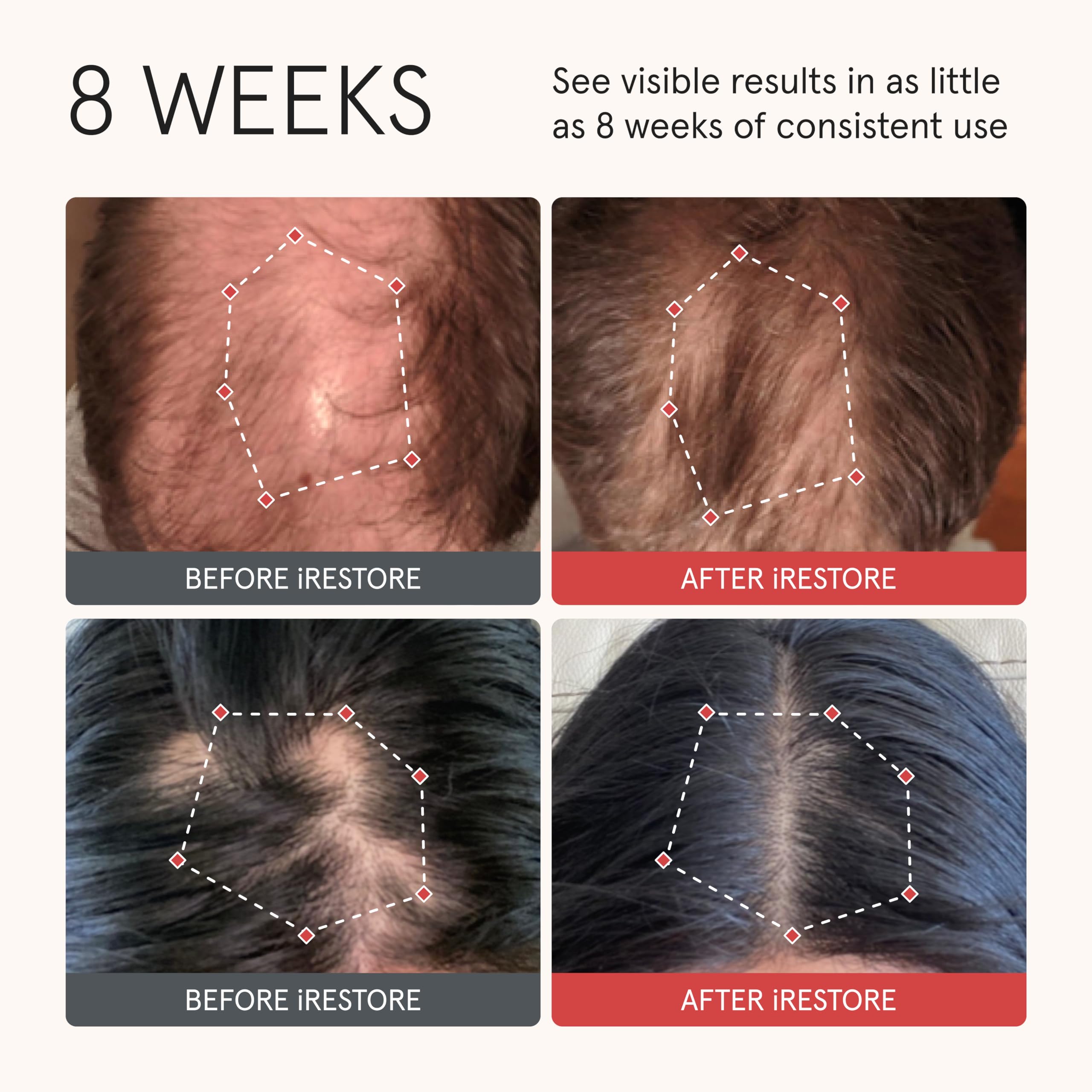iRestore Biotin conditioner with argan oil ingredients shown for nourishing care