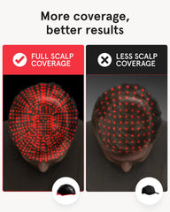 iRestore Elite close-up of coverage area with VCSEL lasers across the scalp