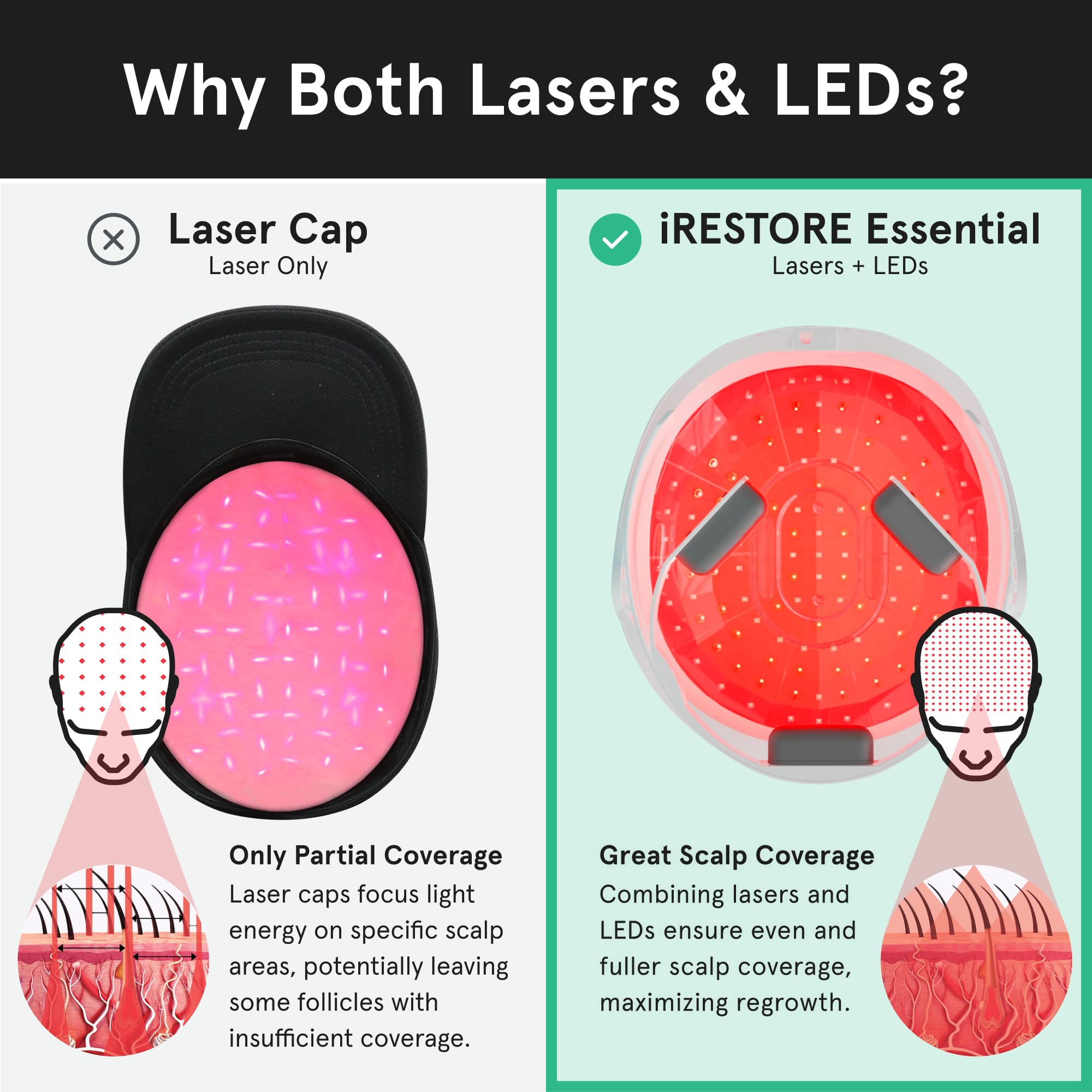 iRestore Essential front view highlights ergonomic cap fit