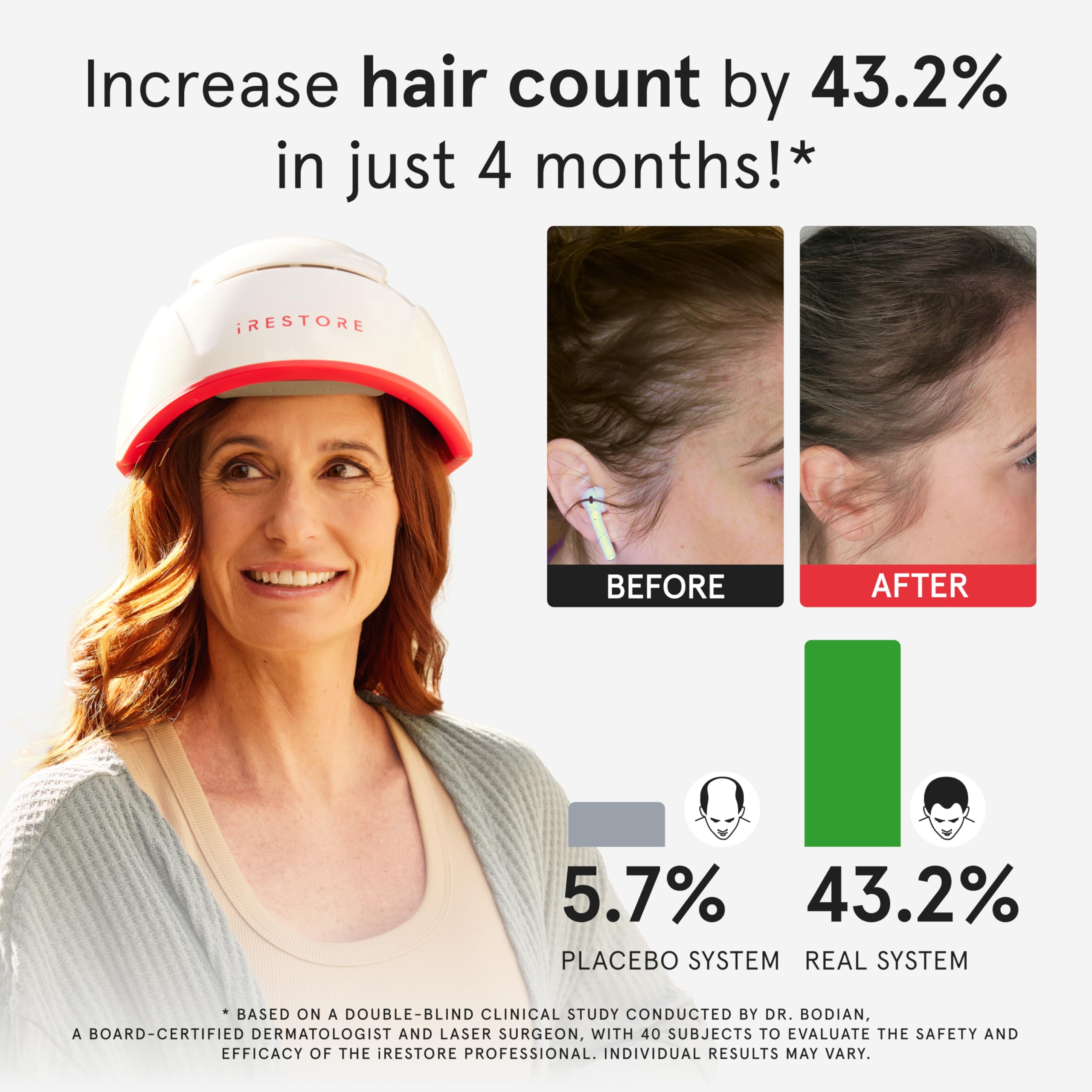 iRestore Pro 282 lasers and LEDs ensure broad coverage across scalp for consistent sessions.