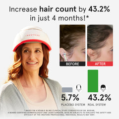 iRestore Pro 282 lasers and LEDs ensure broad coverage across scalp for consistent sessions.