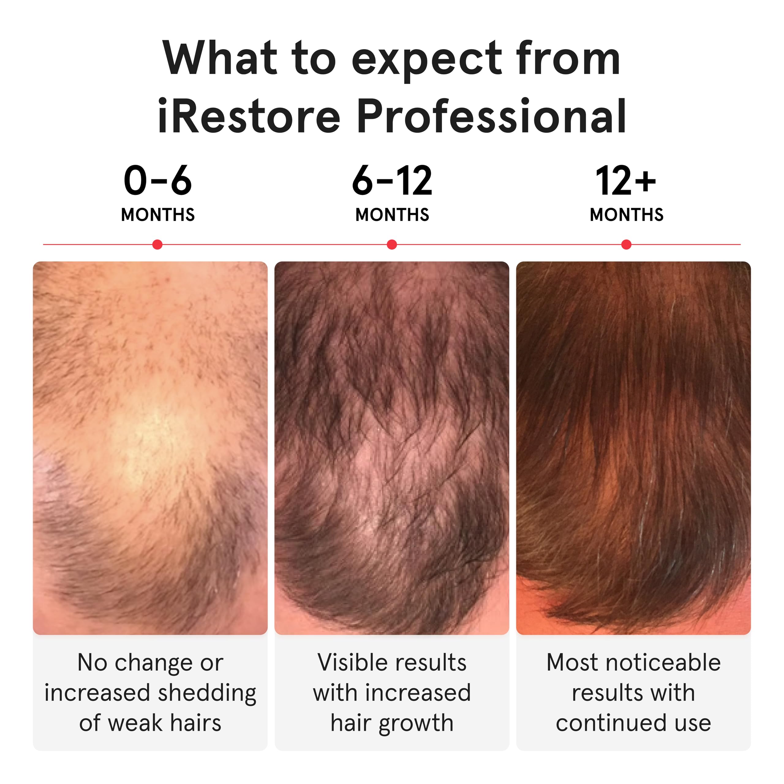 iRestore Pro lightweight, ventilated design ensures a comfortable, secure fit during treatments.