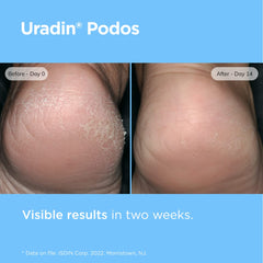 ISDIN Uradin Podos Gel Oil quickly absorbs with a non-greasy feel.