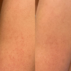 Isle of Paradise Confidently Clear Body Polish applied to skin for renewed, hydrated feel.