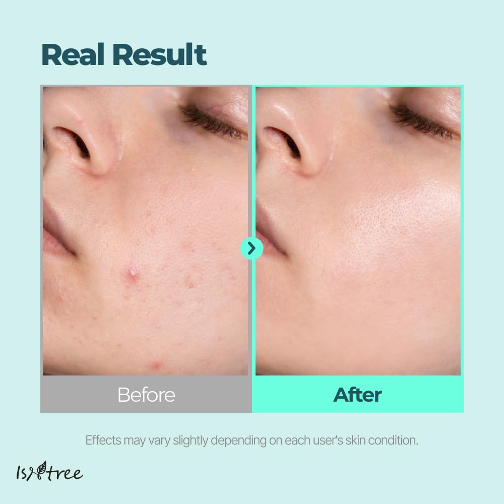 IsNtree Gim PDRN Deep Sleep Mask night routine setup for overnight hydration.