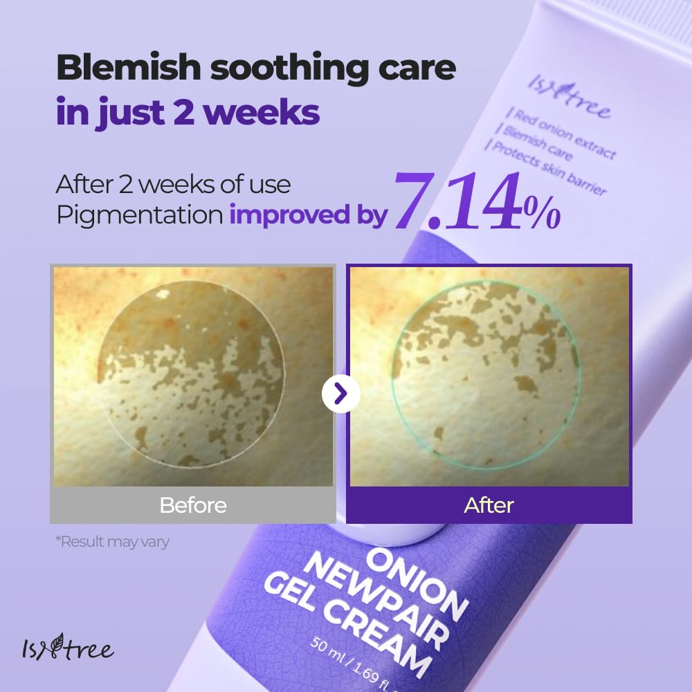 IsNtree Onion Newpair Gel Cream uses 71% red onion extract.