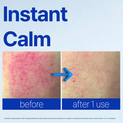 ISOI ACNI Dr. 1st Speedy Gel Cream texture swatch showing cooling relief.