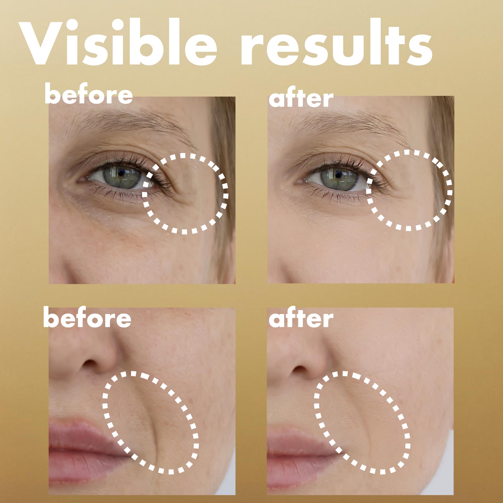 ISOI Intensive Energizing Cream EX face firming supports improved elasticity and resilience.