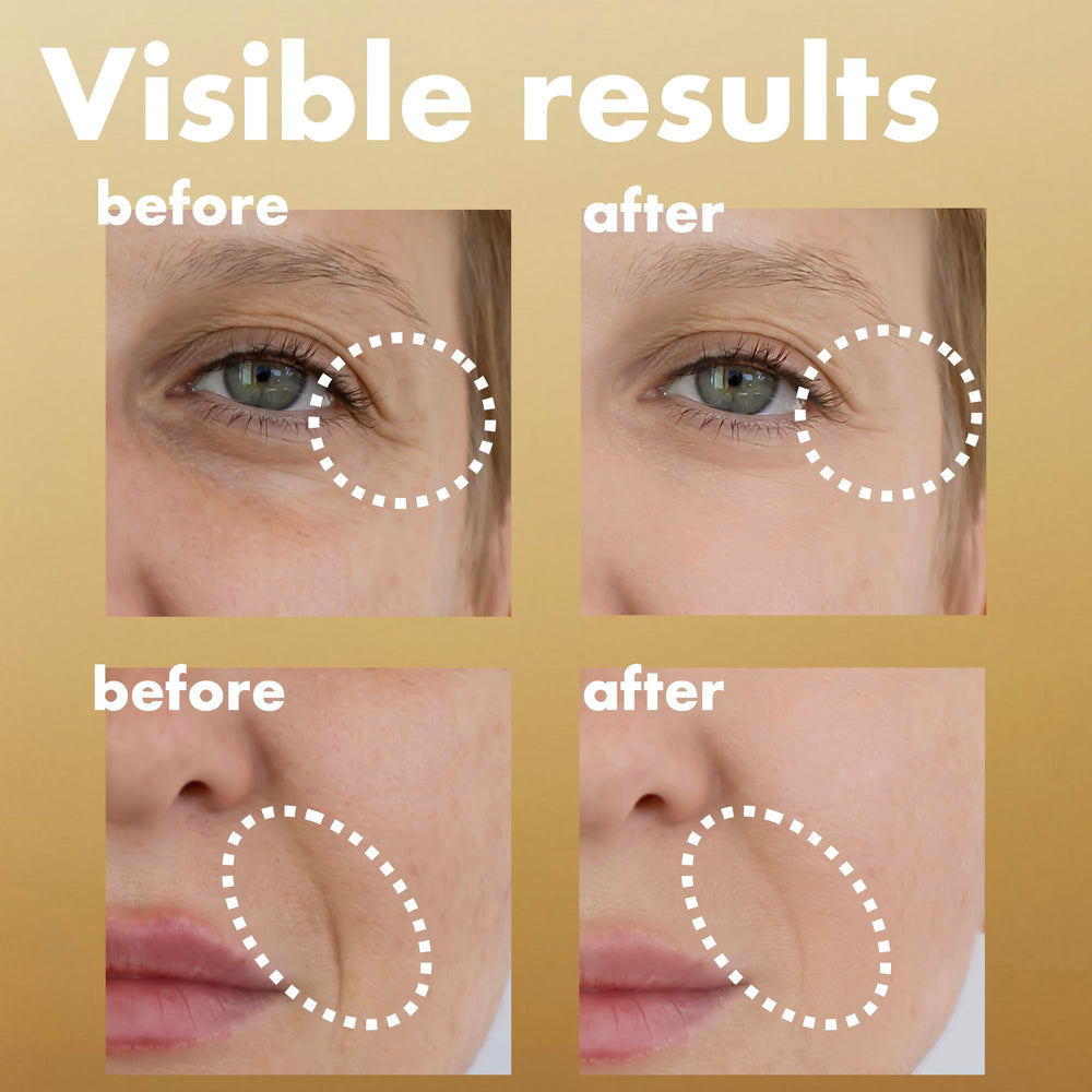 ISOI Intensive Energizing Cream EX face firming supports improved elasticity and resilience.