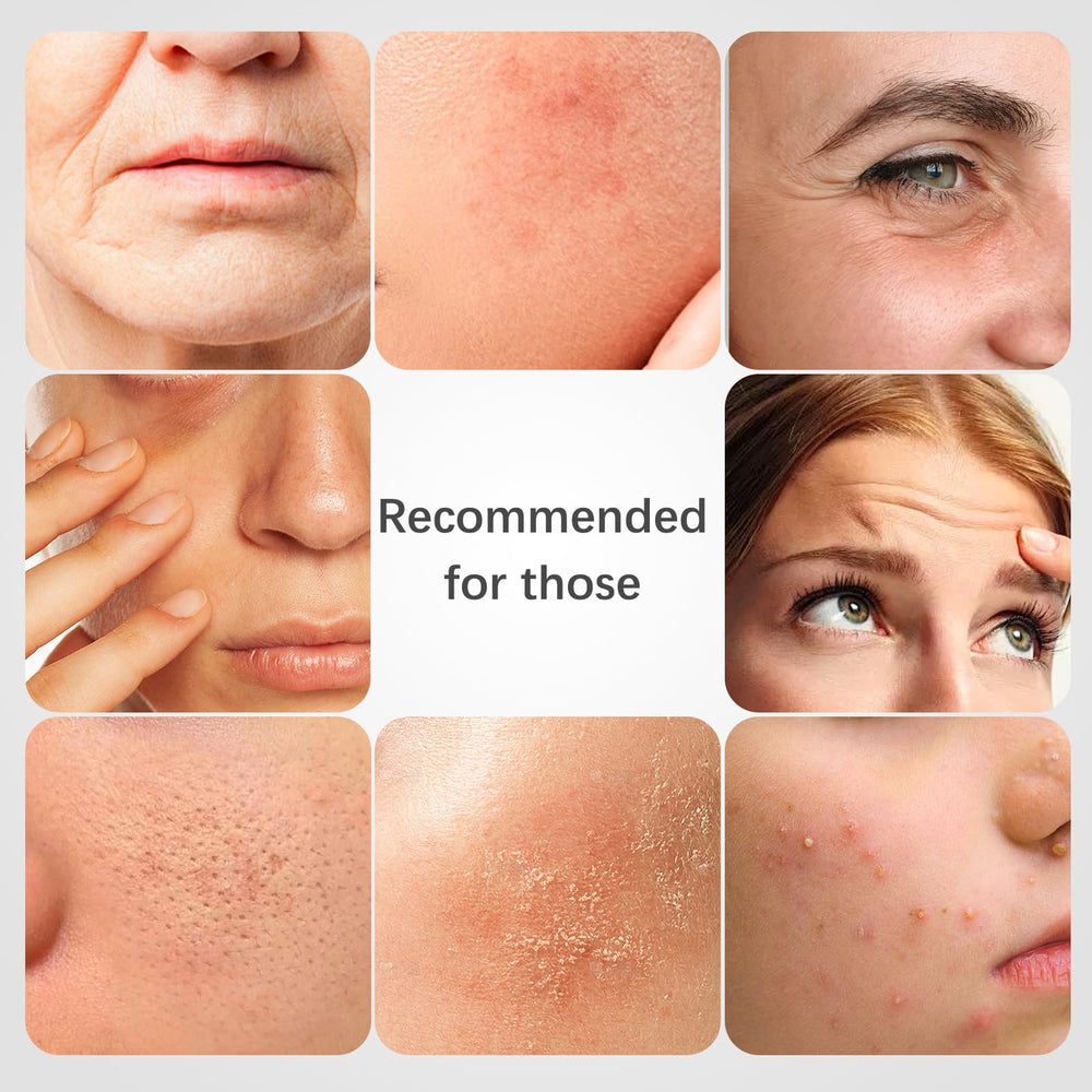 ISTON Hydrating mask sheet visible as a gel veil delivers refreshing moisture.