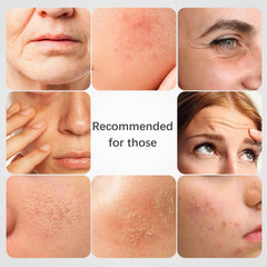 ISTON Hydrating mask sheet visible as a gel veil delivers refreshing moisture.