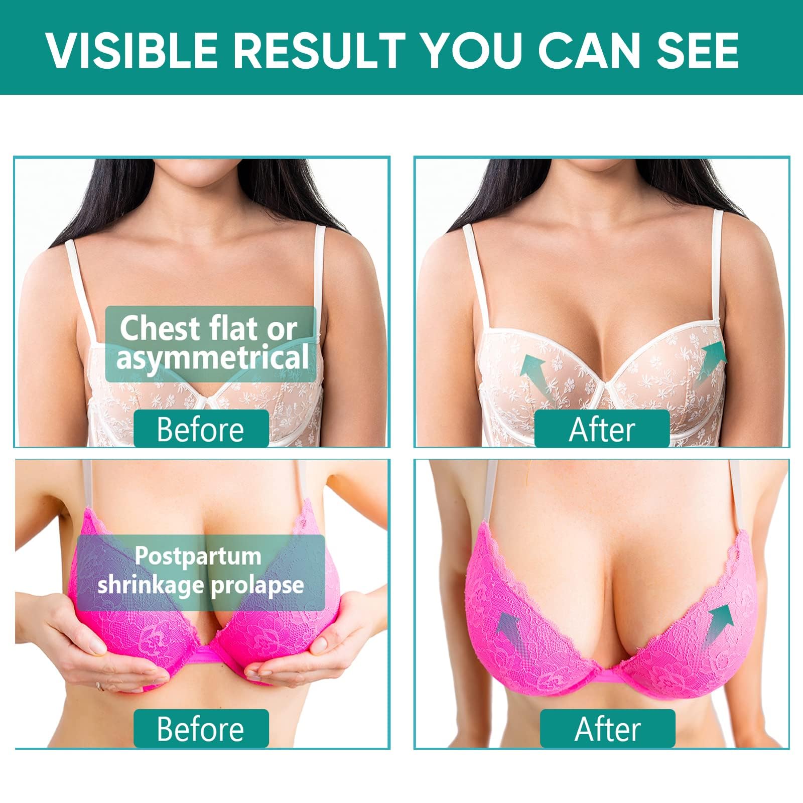 ITECFREELY Packaging box highlights premium, plant-based breast care