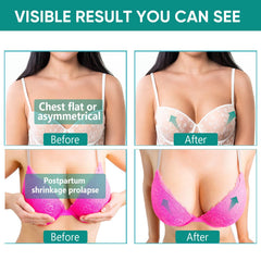 ITECFREELY Packaging box highlights premium, plant-based breast care