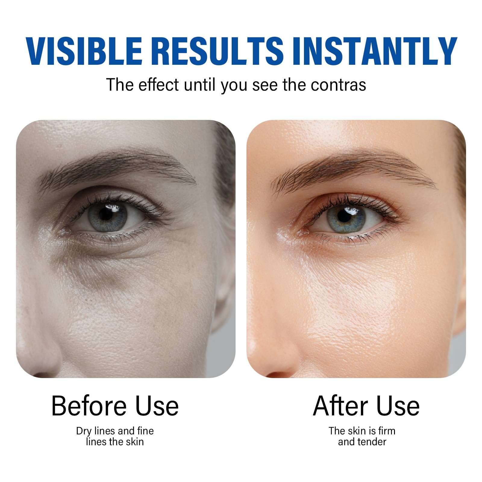 ITECFREELY Instant Eye Tightener 0205 morning routine image suggests refreshed daytime look.