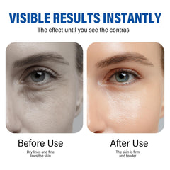 ITECFREELY Instant Eye Tightener 0205 morning routine image suggests refreshed daytime look.