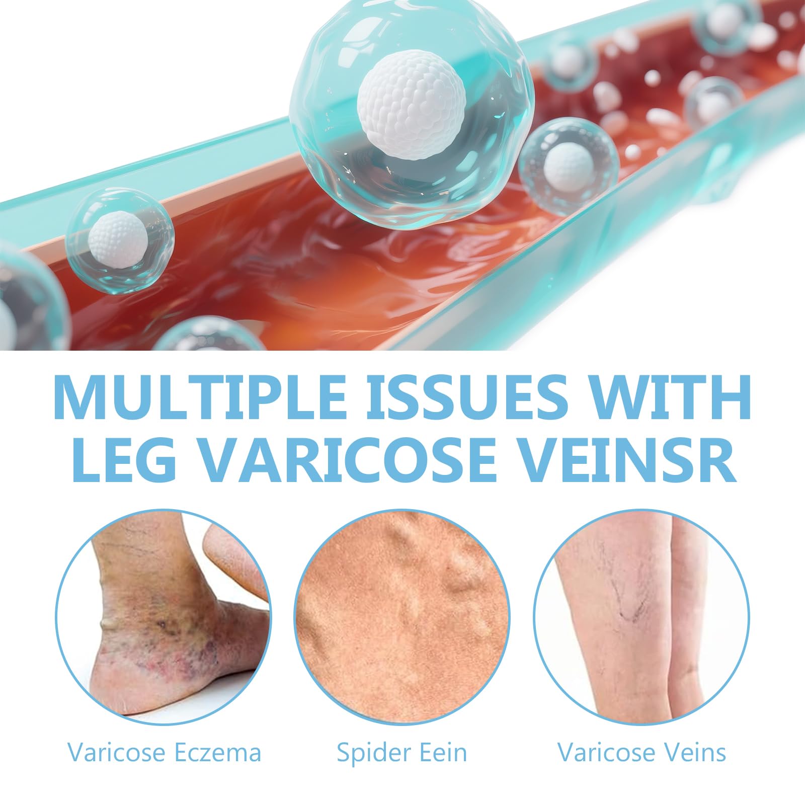 ITECFREELY Varicose Veins Cream application on leg helps soothe tired muscles.