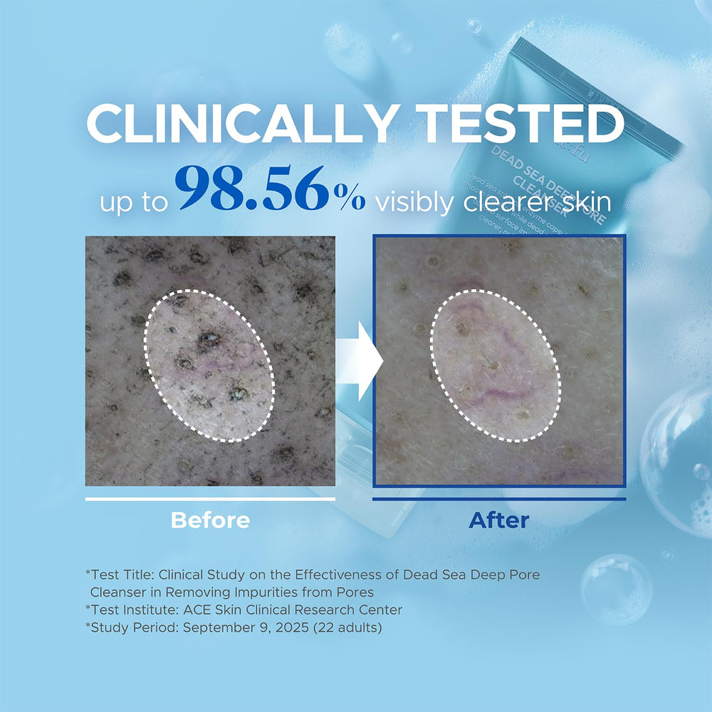 it:fu Deep Pore cleanser hydrates with hyaluronic acid for balanced skin.