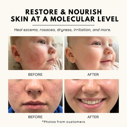 Jeune Jolie whipped tallow body balm delivers long-lasting moisture.