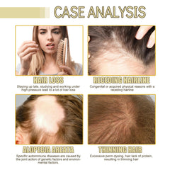 JISKG EELHOE scalp massage during oil use