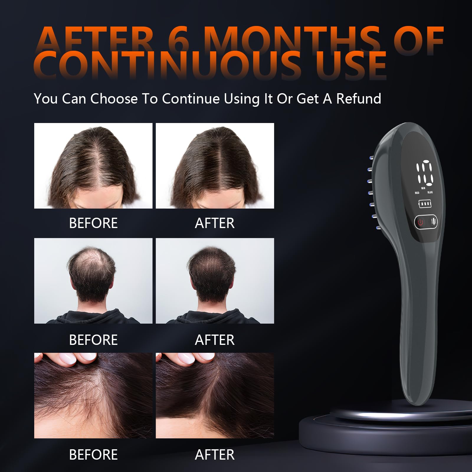 Jitesy Laser Therapy Hair Growth Comb packaging suitable for personal use