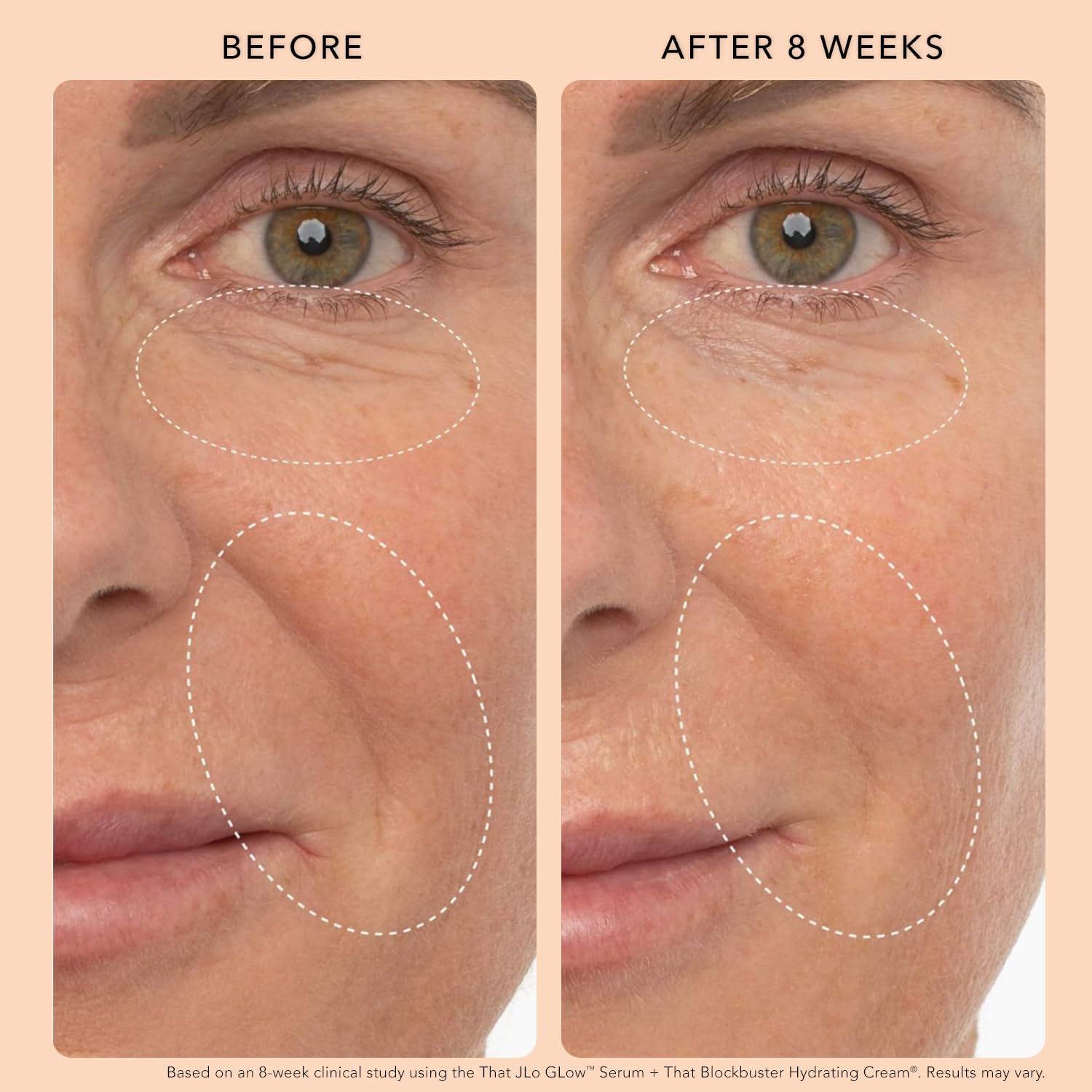 JLO BEAUTY That Blockbuster hyaluronic acid application shot suggests plumping results.
