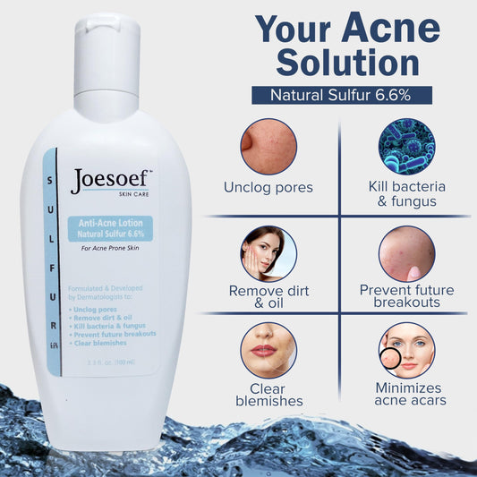 JOESOEF Skin Care acne soap bar cleanses pores and supports blemish control