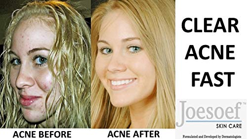 JOESOEF SKIN CARE sulfur-based bar suitable for oily to normal skin routines.