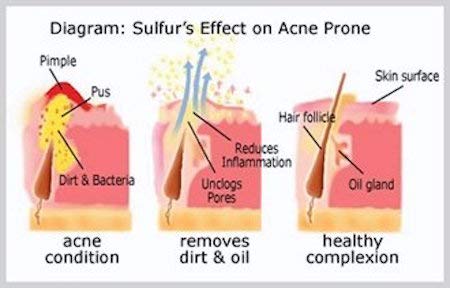 Micronized sulfur detail on JOESOEF soap showing natural volcanic origin and cleansing support