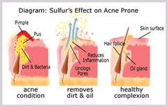 JOESOEF SKIN CARE sulfur soap natural volcanic sulfur origin
