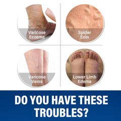 Josera varicose cream application rub shows easy massage technique.