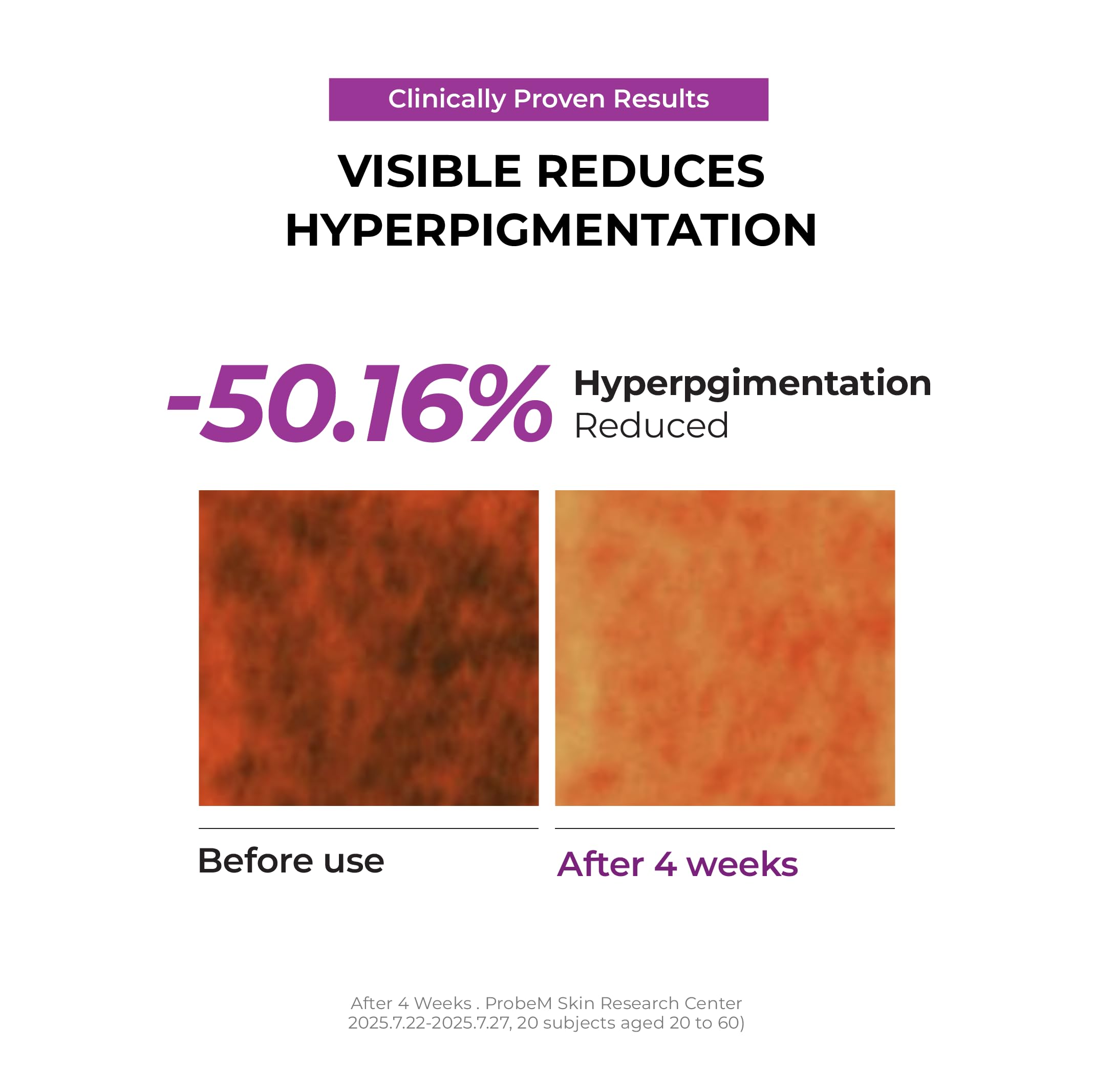 JUMISO brightening effect on uneven tone with visible morning improvement