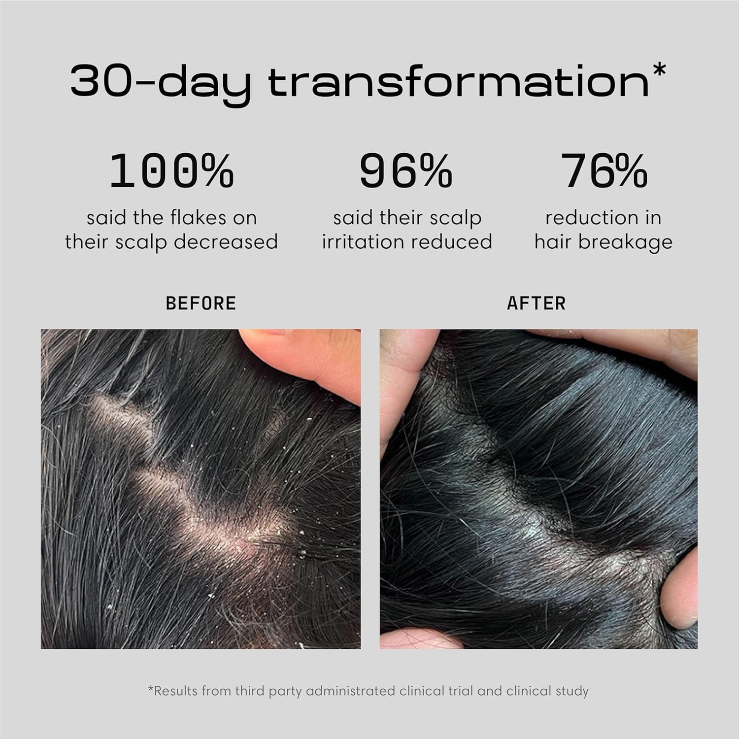 Jupiter Balance Shampoo close-up shows rich lather and cleansing action for flaky scalp.
