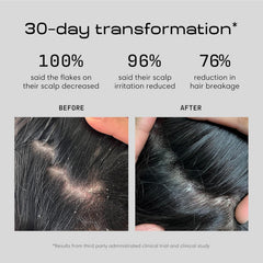 Jupiter Balance Shampoo close-up shows rich lather and cleansing action for flaky scalp.