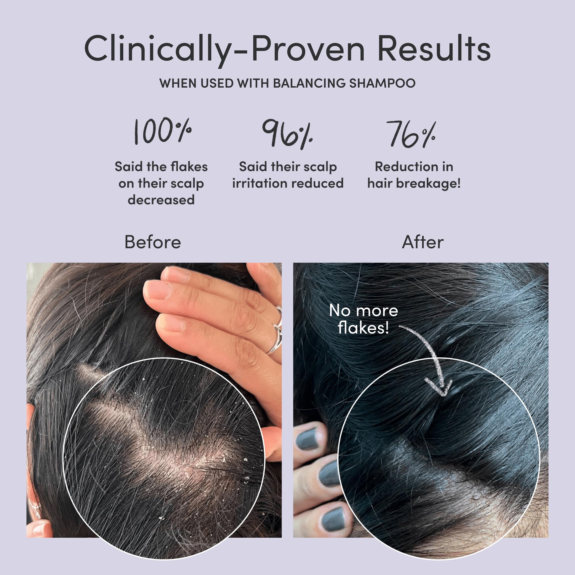 Jupiter Scalp Mask foaming texture demonstrates purifying action before shampoo.