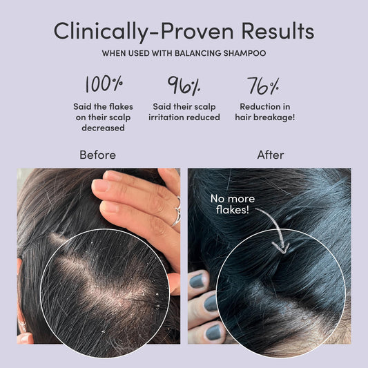 Jupiter Scalp Mask foaming texture demonstrates purifying action before shampoo.