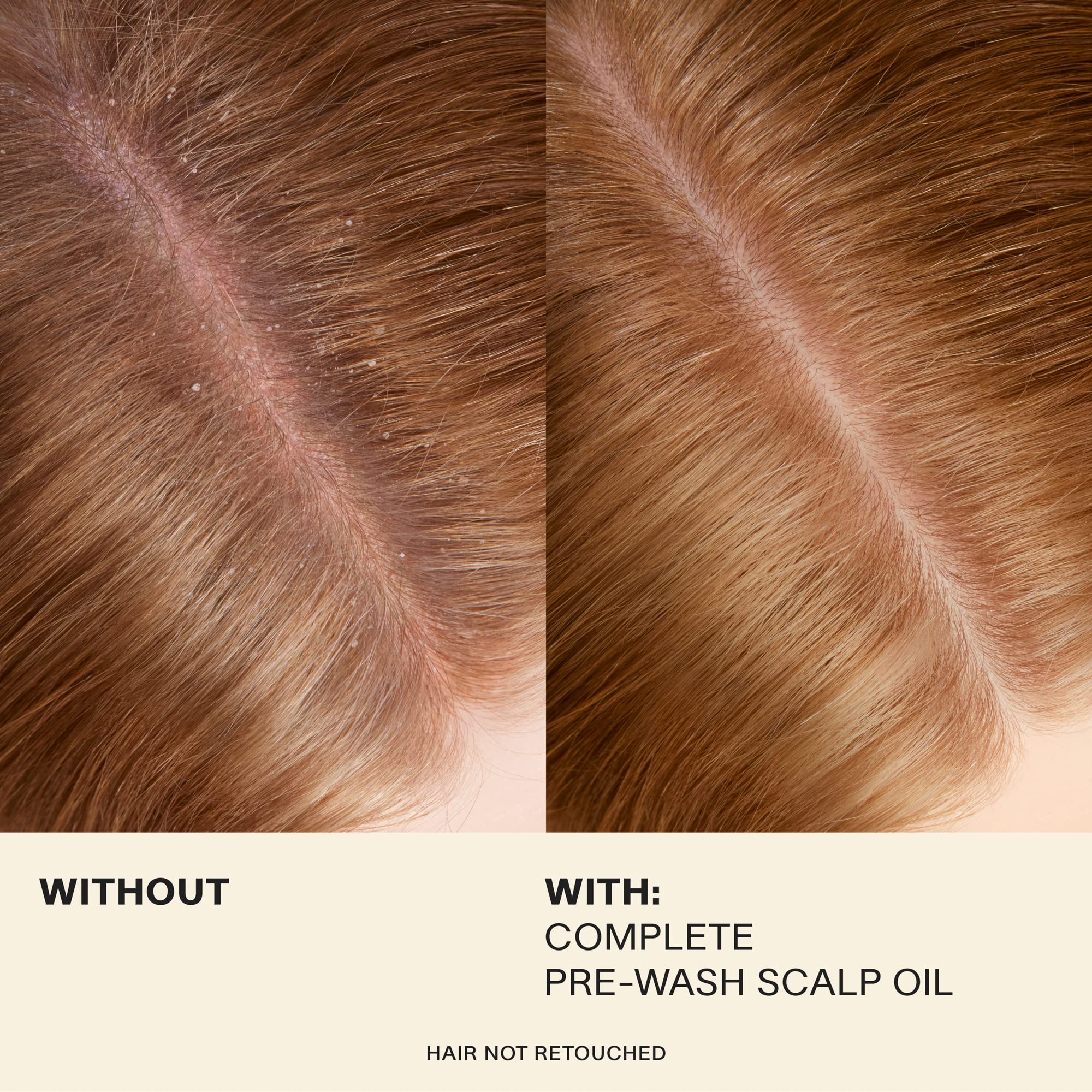 JVN Pre-Wash Scalp Oil application-massage captures soothing prep before washing.