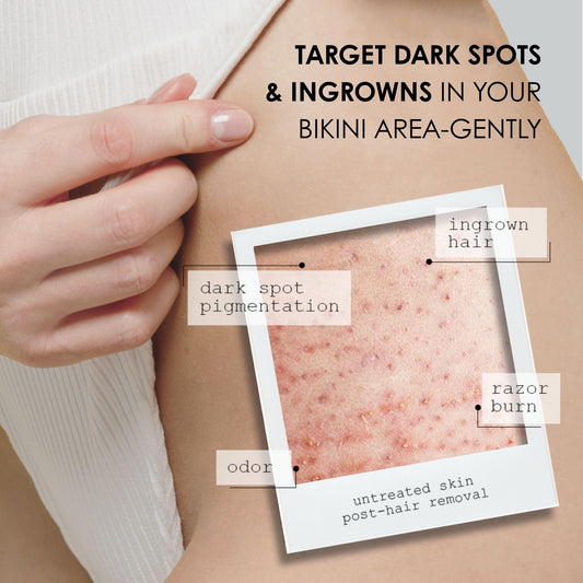 Kaia Naturals Takesumi Bright roll-on application provides quick, fragrance-free daily care.