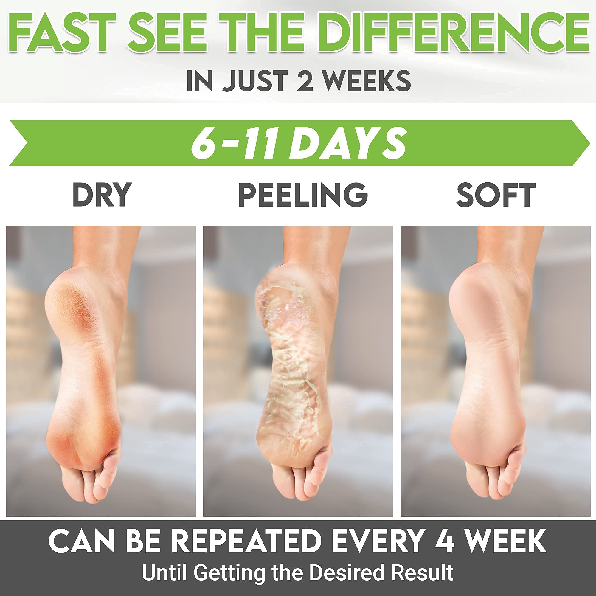 Karma Organic Foot Peel Mask five-step usage guide illustration.