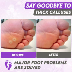 Karma Organic Foot Peel Mask Lavender post-care results with moisturized heels