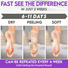 Karma Organic Foot Peel Mask Lavender after-use rinse reveals refreshed feet