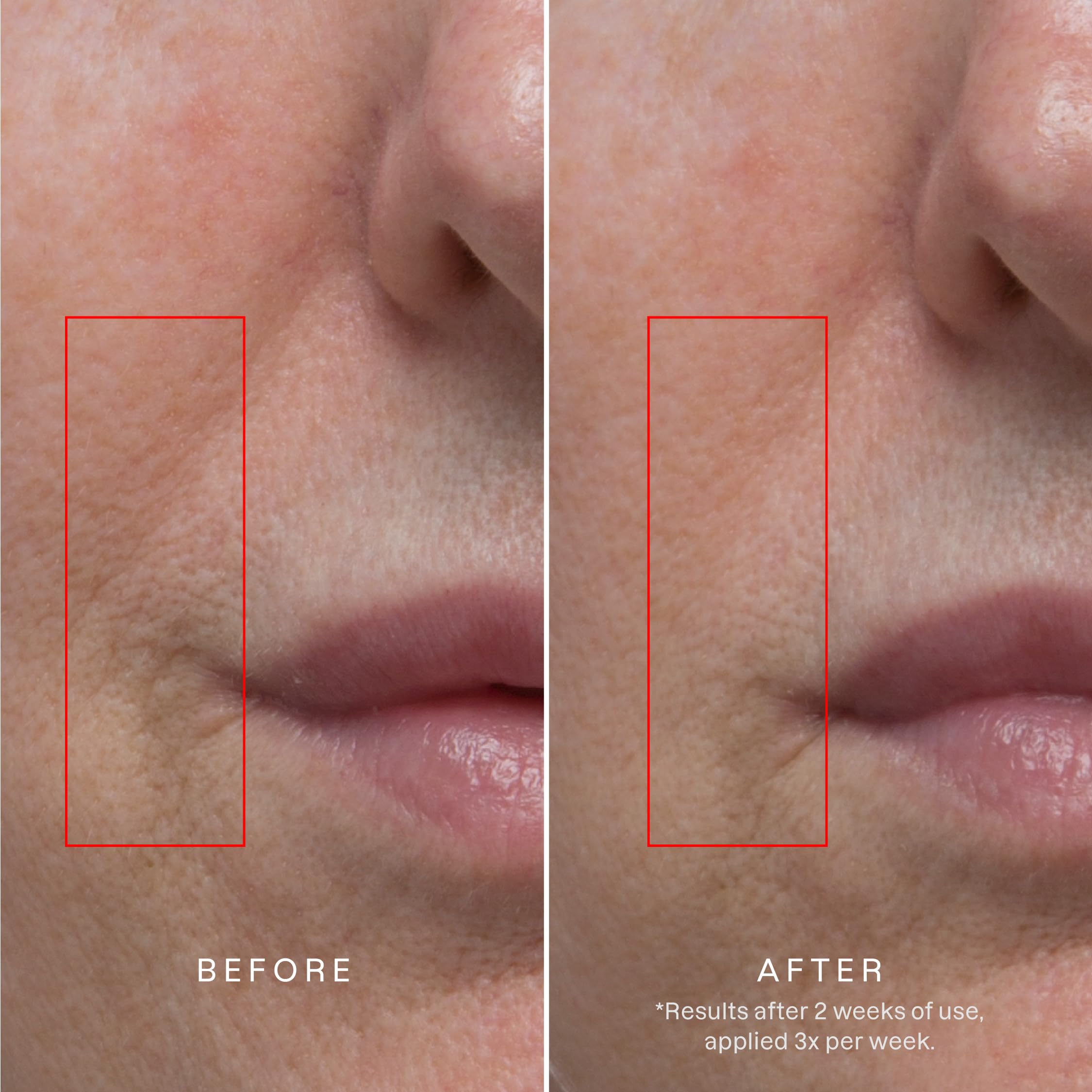 Karuna Age Rewind XL overnight application on skin suggests convenient night-time treatment