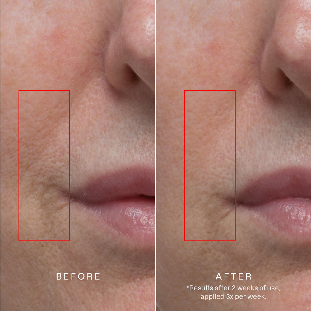 Karuna Age Rewind XL overnight application on skin suggests convenient night-time treatment