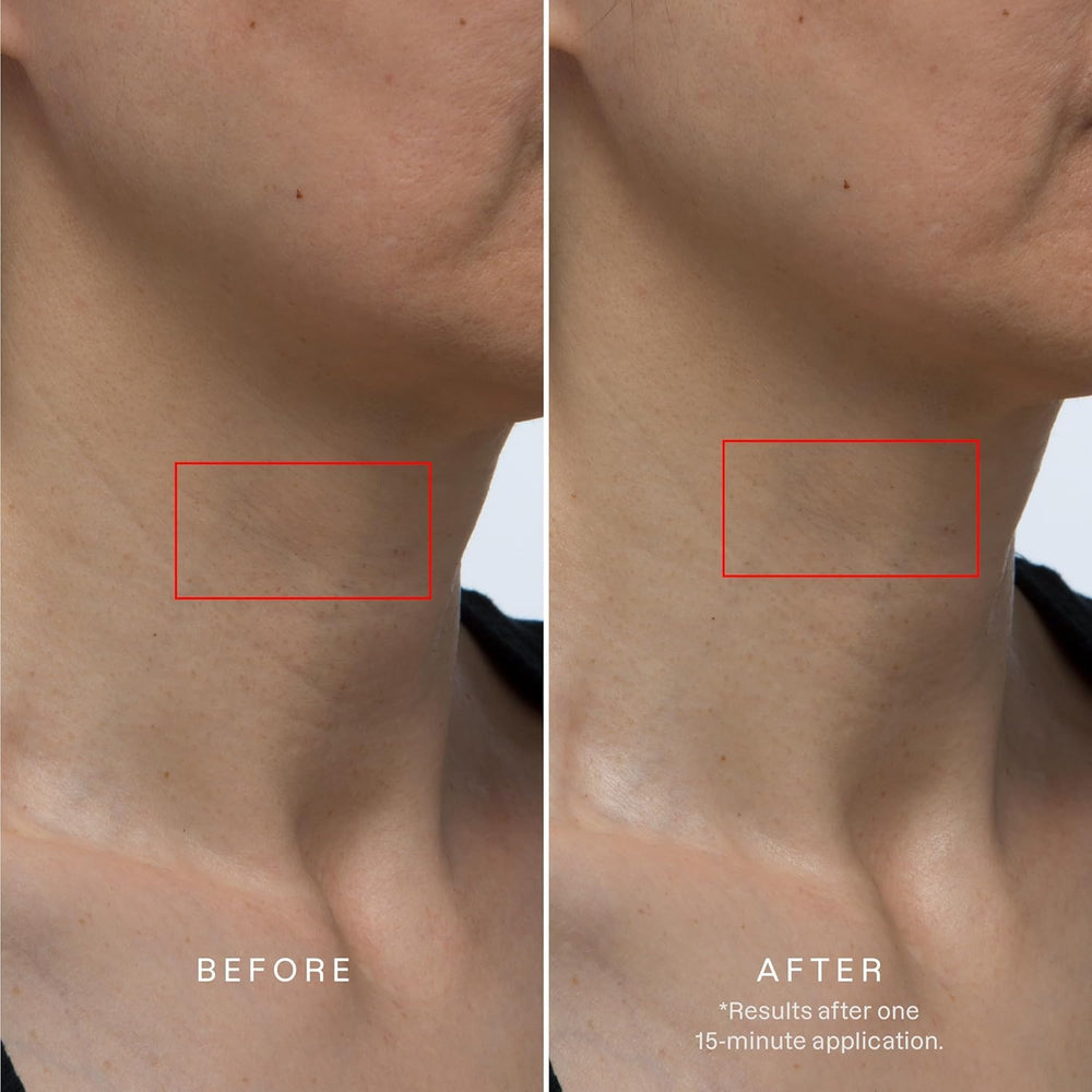 Karuna neck-chest hydrogel mask application close-up demonstrates cooling comfort.