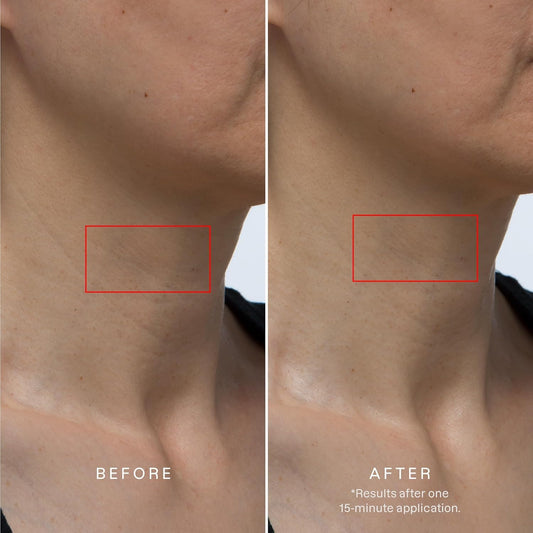 Karuna neck-chest hydrogel mask application close-up demonstrates cooling comfort.