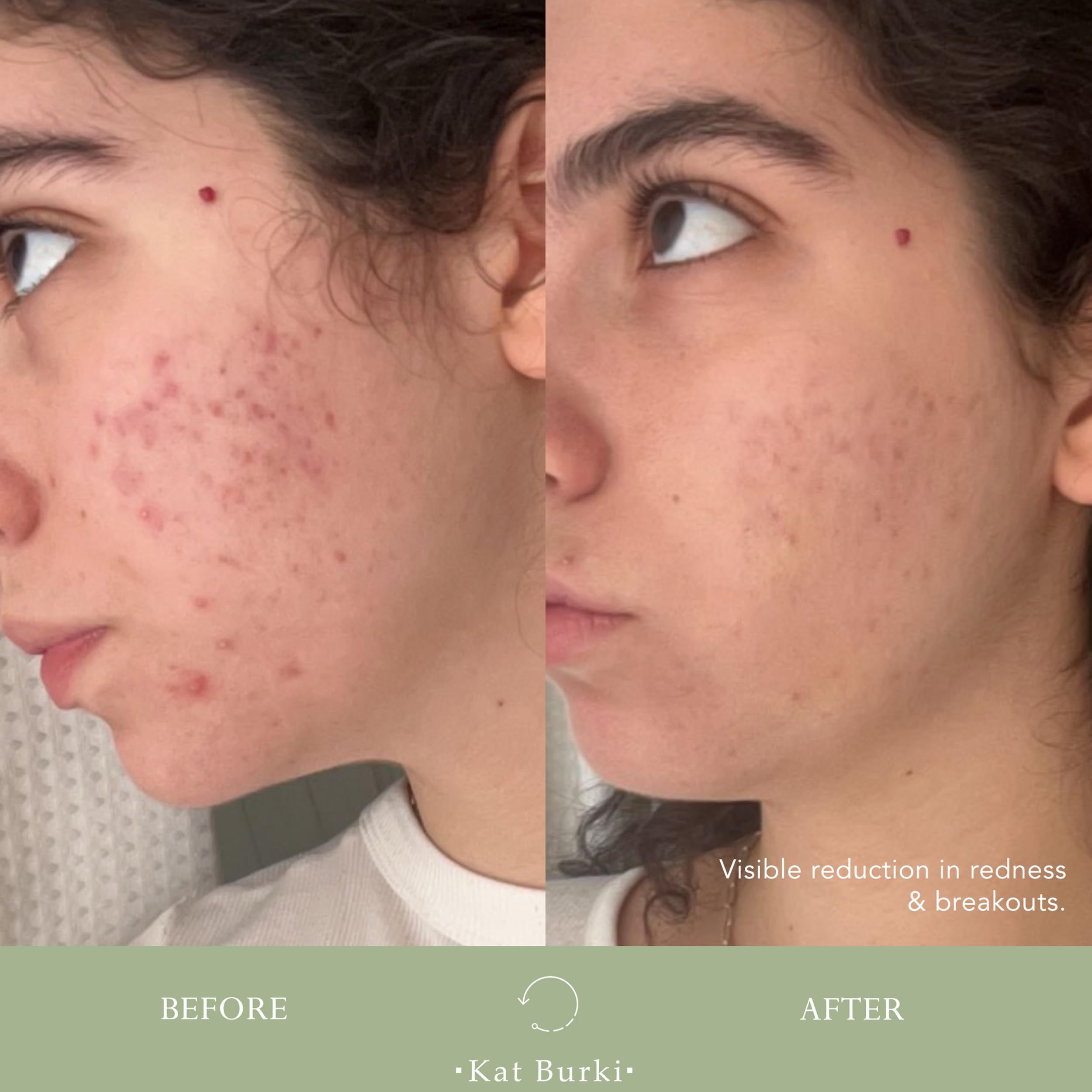 KAT BURKI VitaBiome snow mushroom hydration boost close-up.