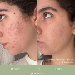 KAT BURKI VitaBiome snow mushroom hydration boost close-up.