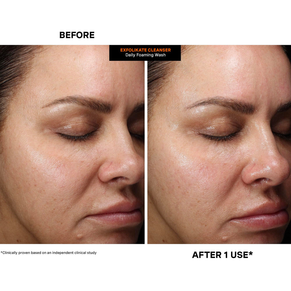 Nighttime cleanse with Exfolikate Cleanser for smoother texture.